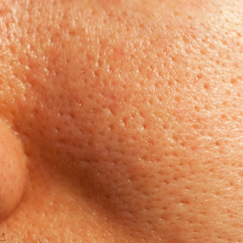 Pores & Grain de Peau