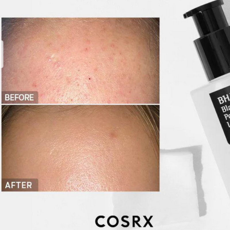 {COSRX} - Powerful BHA Blackhead Liquid