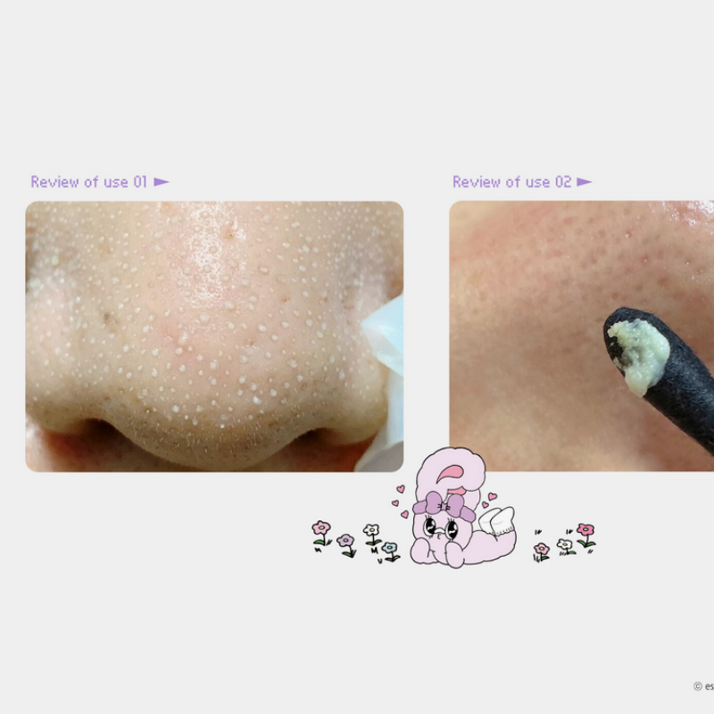 {ILSO} - Soft and Transparent Natural Nose Pack Esther Bunny Edition